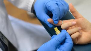 <p>Für einen HIV-Test wird dem Patienten Blut abgenommen und im Labor untersucht.</p>