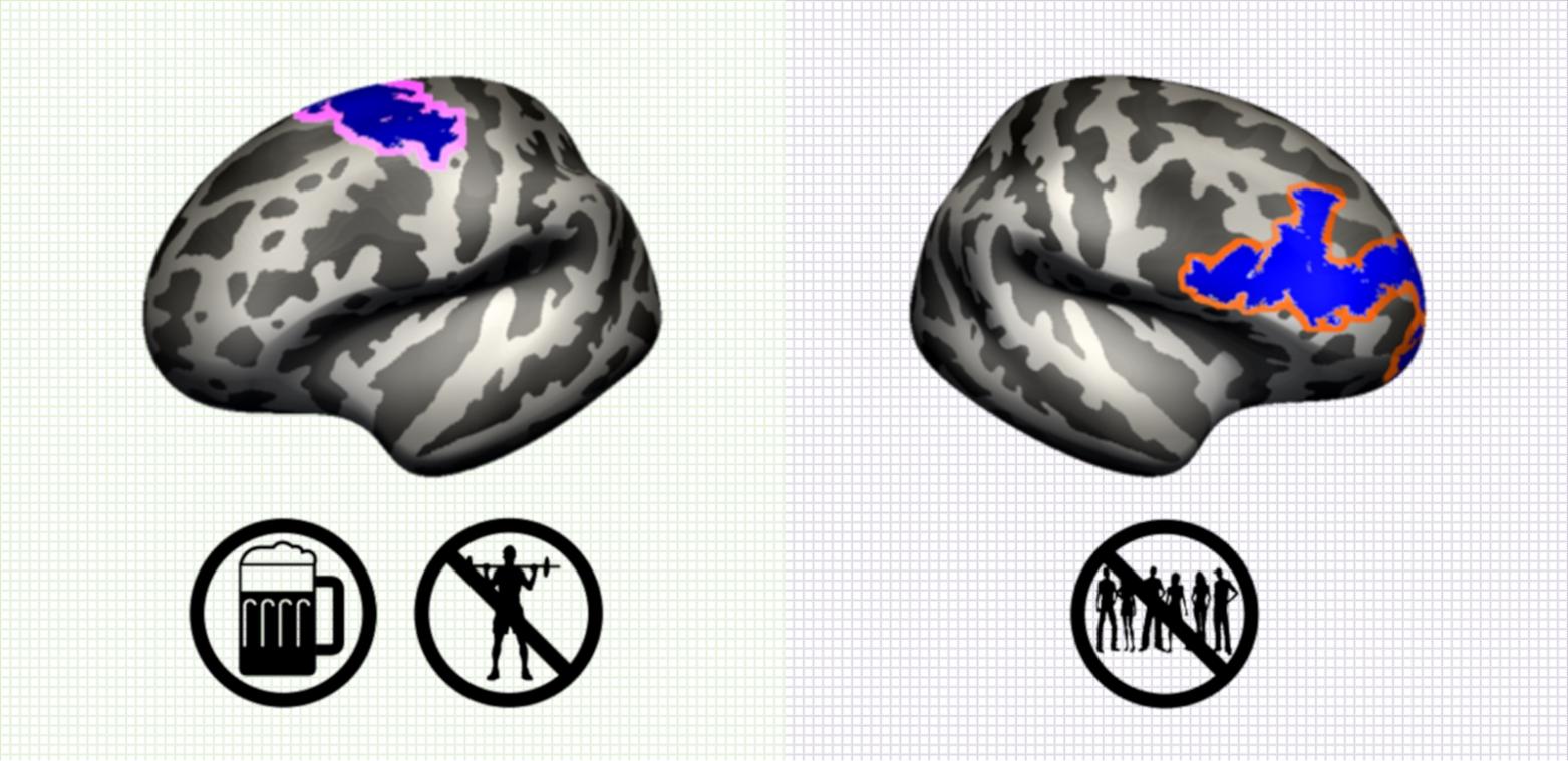 <p>Wirken sich negativ auf die Gehirnstruktur aus: Alkohol und mangelnde sportliche Aktivität (links) und fehlende soziale Interaktionen (rechts).</p>