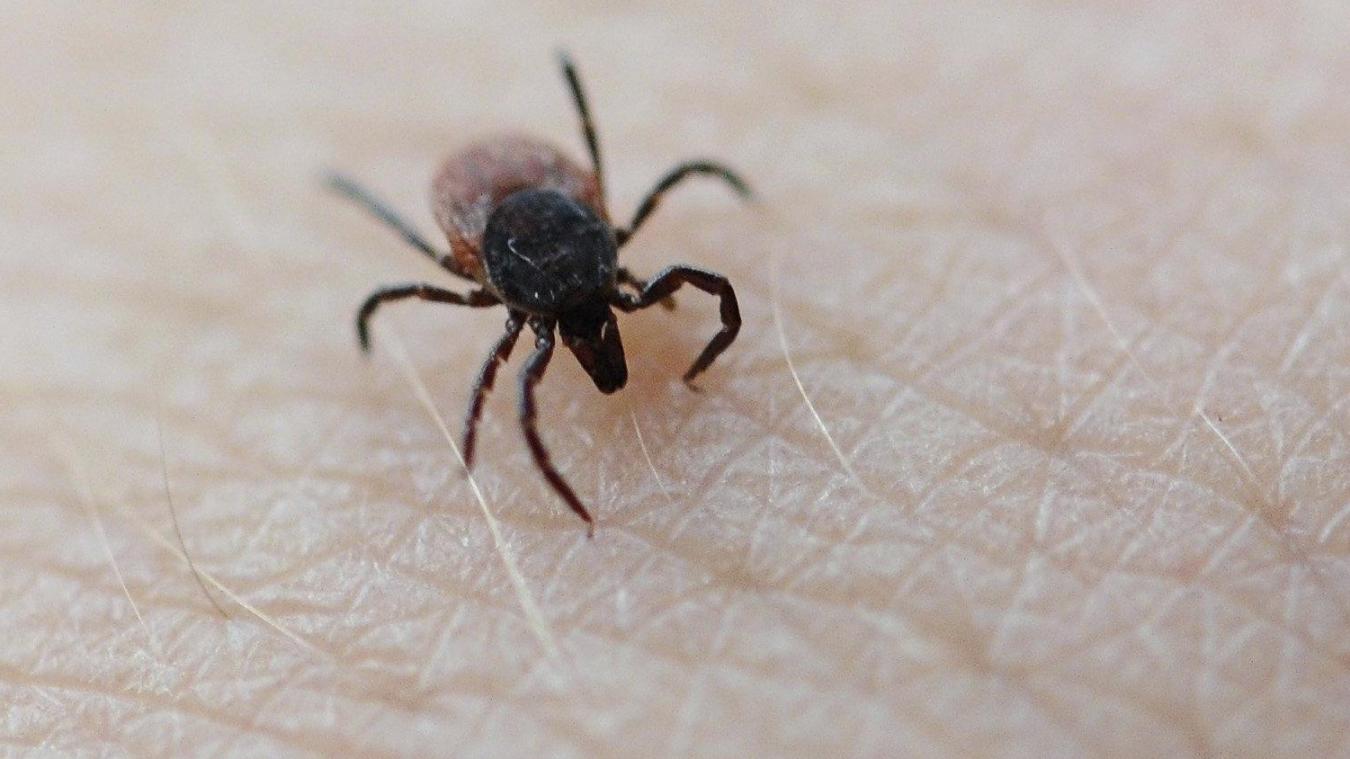 <p>Zecken suchen sich einen geeigneten Platz auf der Haut, um Blut zu saugen.</p>