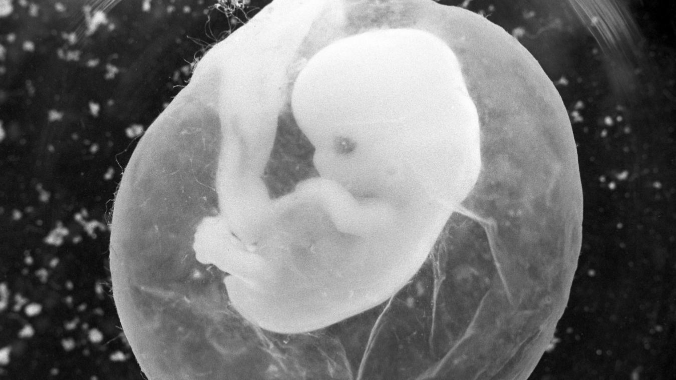 <p>Ein sieben Wochen alter Fötus in einer Fruchtblase: In Belgien könnte das Abtreibungsgesetz wieder geändert werden.</p>