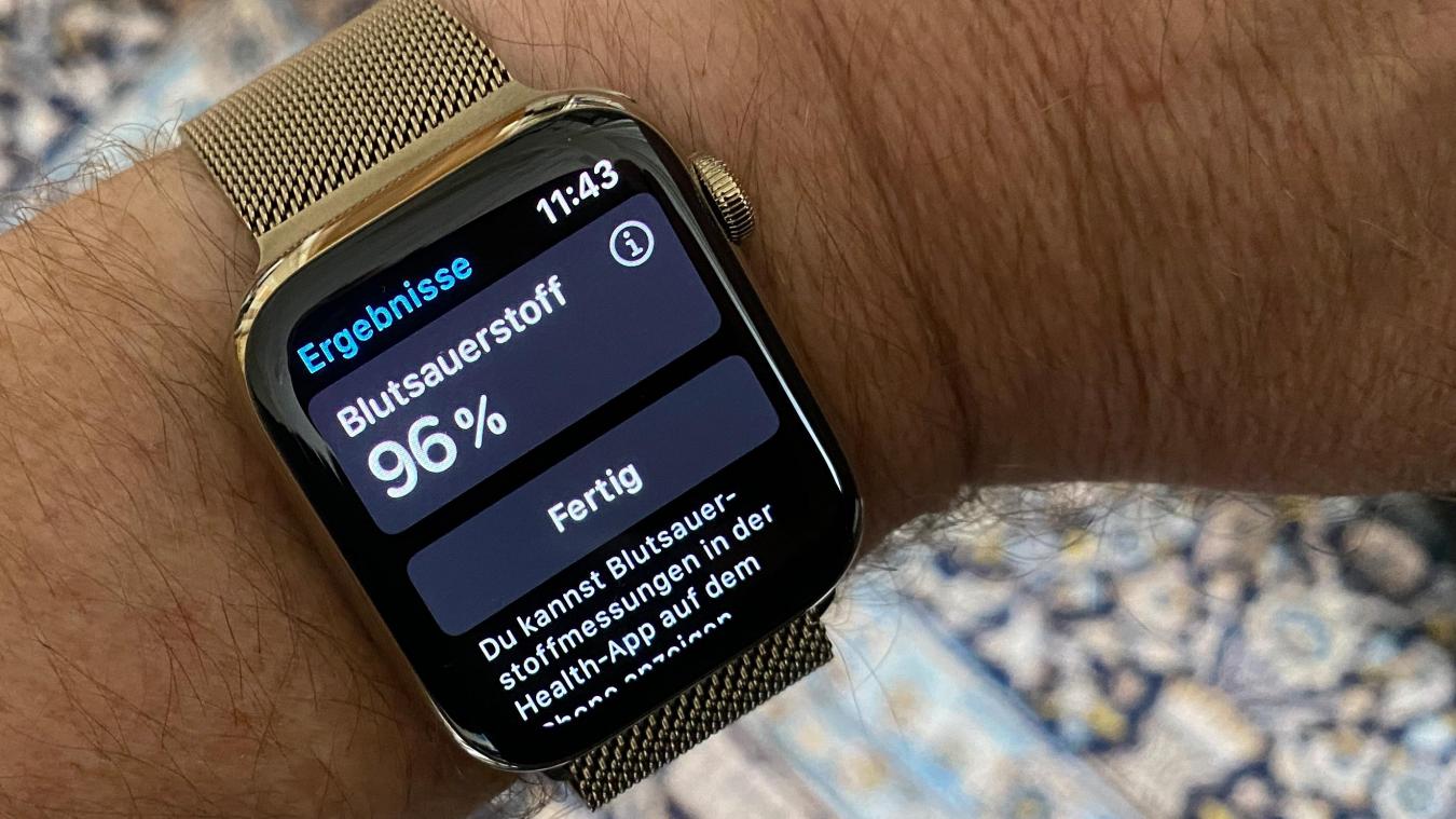<p>Die Apple Watch Series 6 kann Puls und Blutsauerstoff messen und auch ein EKG erstellen.</p>