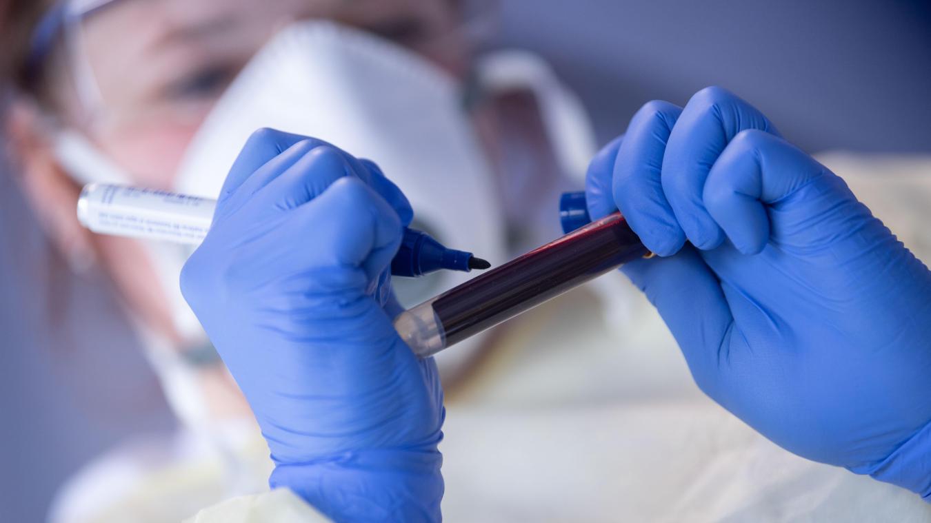 <p>Ein Mitarbeiterin des Robert Koch-Instituts (RKI) beschriftet eine Blutprobe für einen Antikörpertest.</p>