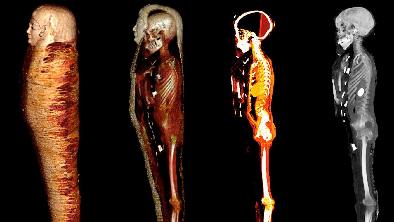 <p>Das digitale Abbild zeigt das Innere der Mumie „Goldjunge“ in vier Schichten.</p>