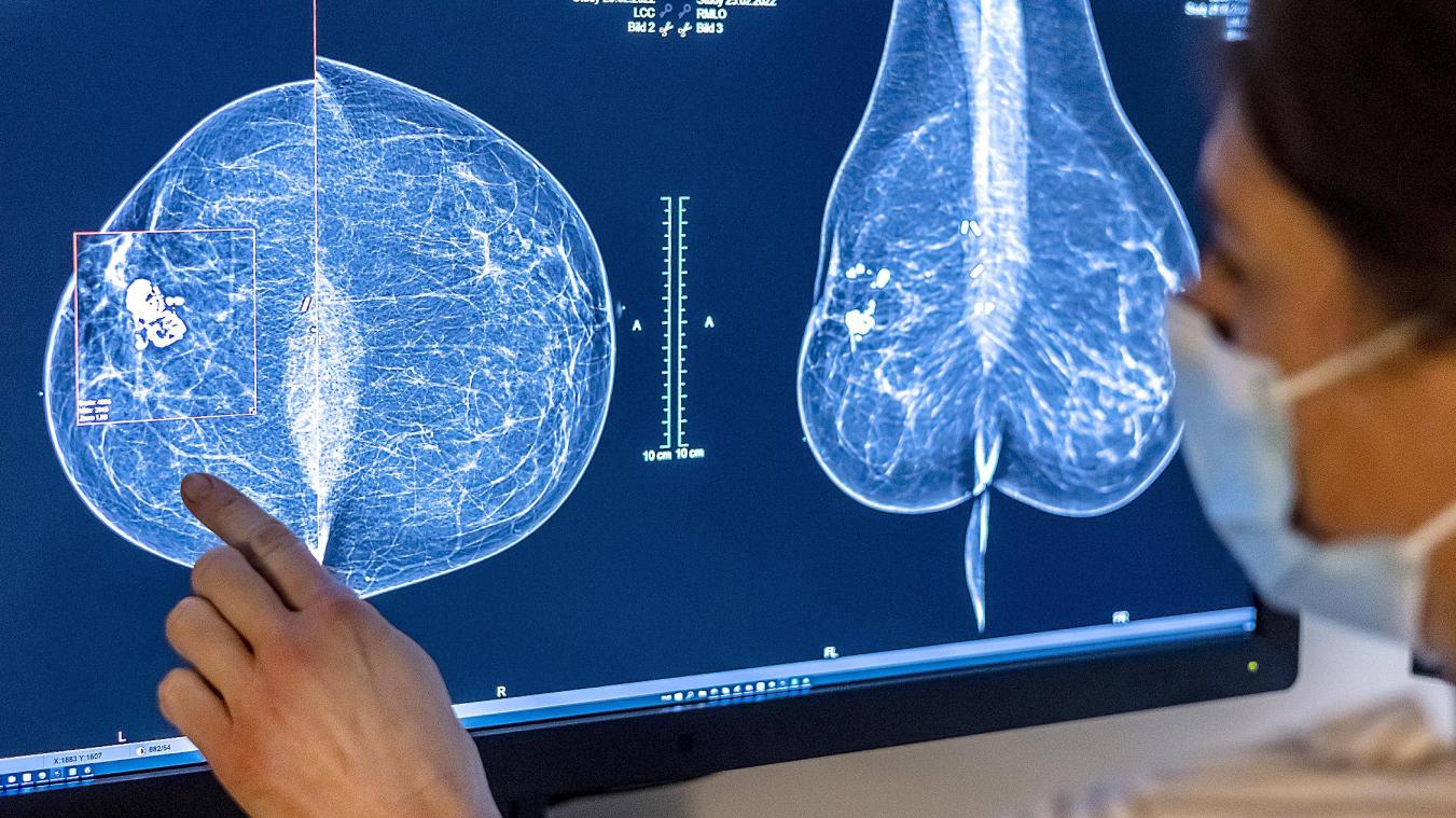 <p>Mehr als 10.000 Frauen erkranken pro Jahr in Belgien an Brustkrebs.</p>