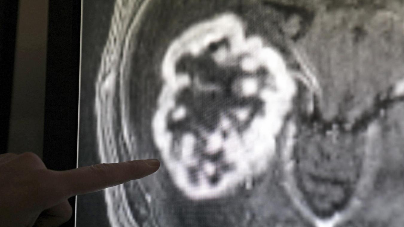 <p>Die Krebsdiagnose soll in Belgien in den kommenden Jahren verbessert werden.</p>