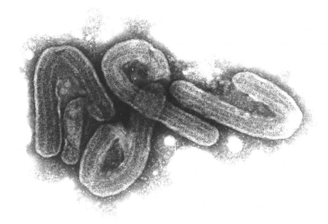 <p>Das Marburg-Virus gehört zu den gefährlichsten bekannten Krankheitserregern.</p>