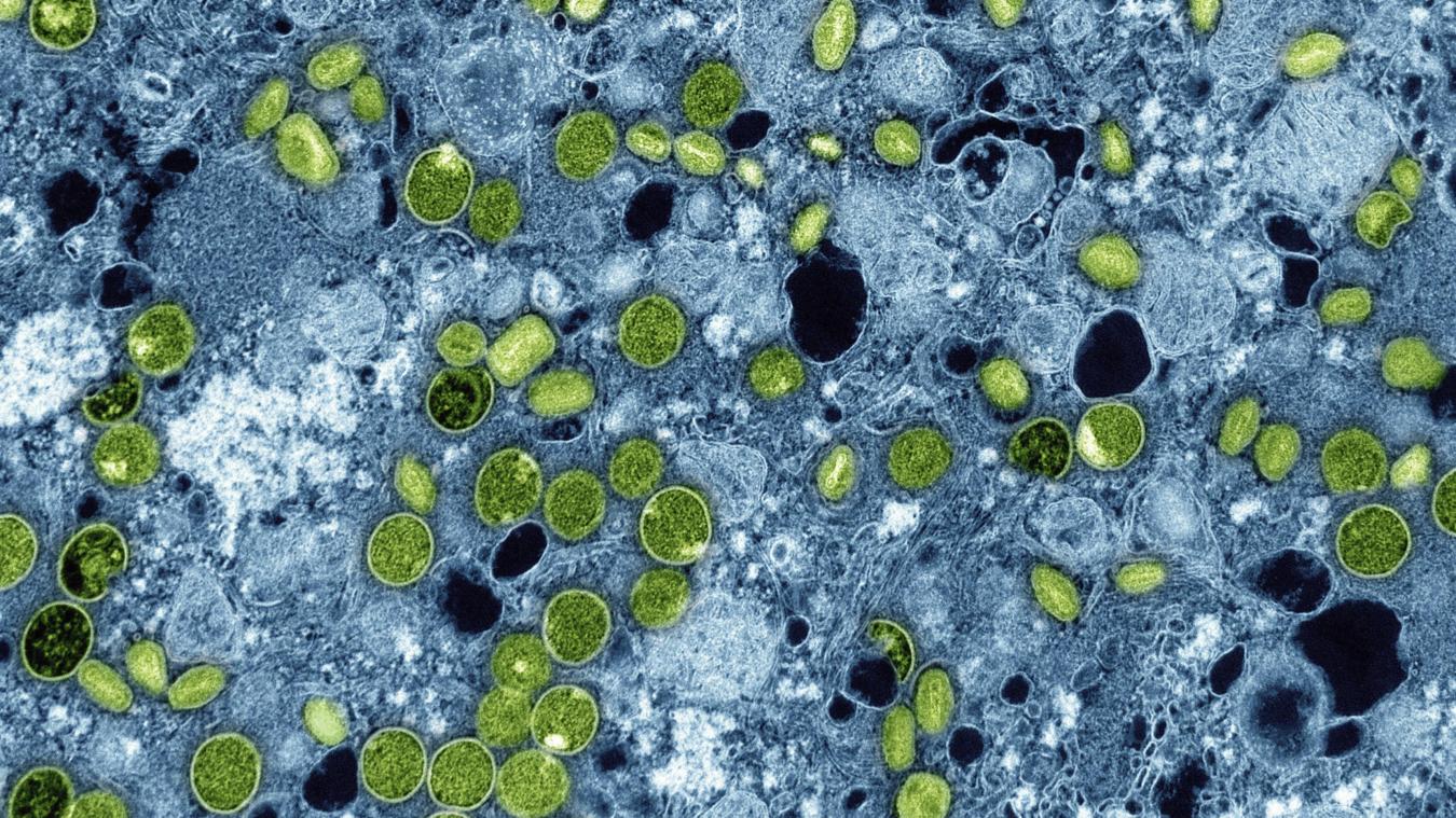 <p>iese kolorierte elektronenmikroskopische Aufnahme des National Institute of Allergy and Infectious Diseases aus dem Jahr 2024 zeigt Mpox-Viruspartikel (grün), die sich in infizierten kultivierten Zellen (blau) befinden. Die Viruspartikel befinden sich in verschiedenen Reifestadien, was zu Unterschieden in der Form führt.</p>