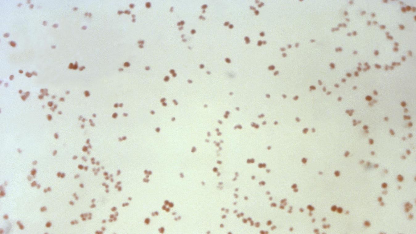 <p>Dieses von den Centers for Disease Control and Prevention zur Verfügung gestellte Mikroskopbild von 1971 zeigt Neisseria gonorrhoeae Bakterien, die die Geschlechtskrankheit Gonorrhö verursachen.</p>