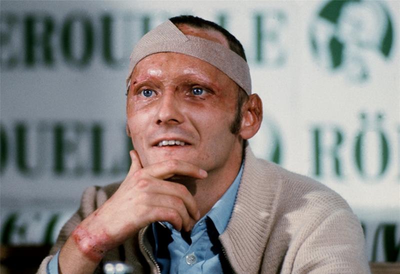 <p>Fünf Wochen nach seinem schweren Rennunfall auf dem Nürburgring präsentierte sich Niki Lauda im September 1976 bei einer Pressekonferenz mit vernarbtem Gesicht, Kopfbandage und Brandwunden.</p>