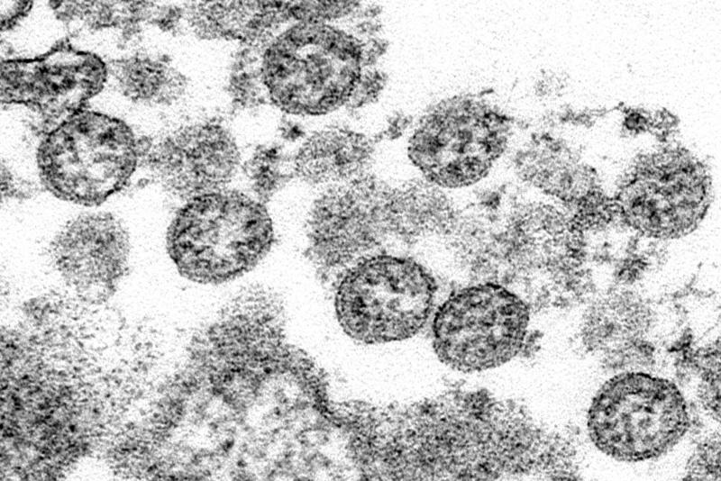 <p>Diese Aufnahme des Zentrums für Krankheitskontrolle und Prävention (CDC) der Vereinigten Staaten zeigt die kugelförmigen Partikel des neuartigen Coronavirus unter einem Elektronenmikroskop.</p>