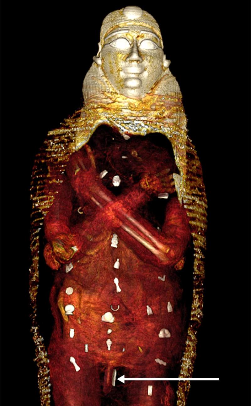 <p>Das digitale Abbild zeigt die Amulette (weiß), die in drei Spalten im Inneren der Mumie „Goldjunge“ platziert wurden.</p>