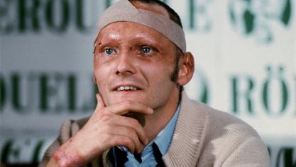 <p>Fünf Wochen nach seinem schweren Rennunfall auf dem Nürburgring präsentierte sich Niki Lauda im September 1976 bei einer Pressekonferenz mit vernarbtem Gesicht, Kopfbandage und Brandwunden.</p>