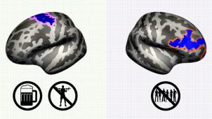 <p>Wirken sich negativ auf die Gehirnstruktur aus: Alkohol und mangelnde sportliche Aktivität (links) und fehlende soziale Interaktionen (rechts).</p>