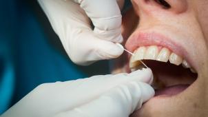 <p>Zahn um Zahn: Ein gesundes Gebiss hält auch den Körper gesund</p>