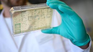 <p>Weltweit wird fieberhaft nach einem Impfstoff gegen das Coronavirus gesucht.</p>
