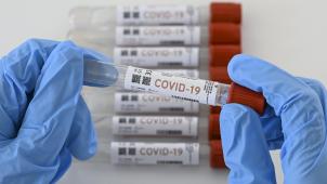<p>Es gibt ausreichend Kapazitäten, um auch Personen ohne Symptome nach nur einer Woche Quarantäne zu testen.</p>
