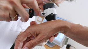 <p>Seit März wurde vor allem weniger Hauptkrebs diagnostiziert.</p>
