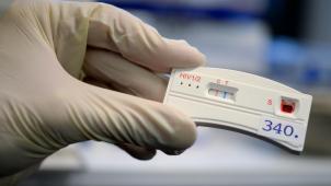 <p>Vor dem Welt-Aids-Tag warnen Europas führende Gesundheitsinstitutionen davor, dass HIV-Ansteckungen auf dem Kontinent zu häufig erst sehr spät erkannt werden.</p>