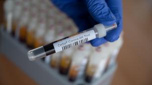 <p>Blutprobe für einen Corona-Antikörper-Test.</p>