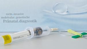 <p>Der NIP-Test sollen über eine vorgeburtliche Blutentnahme Aufschluss über eine mögliche Erkrankung des Kindes an Trisomie 21 geben.</p>