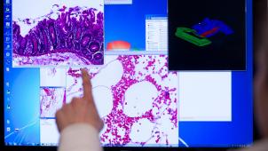 <p>Im Jahr 2020 wurden in Belgien 4.000 Krebsdiagnosen weniger verzeichnet als eigentlich erwartet.</p>