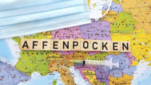 <p>Die WHO hatte den Affenpocken-Ausbruch zu einer „Notlage von internationaler Tragweite“ erklärt. Das DG-Ministerium rechnet auch in Ostbelgien mit Fällen.</p>