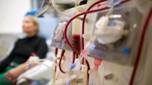 <p>Ein Patientin mit chronischer Niereninsuffizienz ist an einem Dialysegerät angeschlossen und erhält eine Butreinigung.</p>