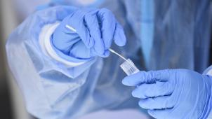 <p>Sogenannte PCR-Tests für die Allgemeinbevölkerung sowie für asymptomatische Personen im Gesundheitssektor und Bewohner von Wohn- und Pflegezentren werden nicht mehr empfohlen. Anders fällt die Entscheidung dagegen für symptomatische Patienten und Bewohner aus.</p>