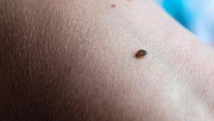 <p>Bettwanzen sind nachtaktiv und Meister im Verstecken.</p>