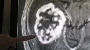 <p>Die Krebsdiagnose soll in Belgien in den kommenden Jahren verbessert werden.</p>
