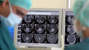 <p>Operation eines Patienten mit einem Hirntumor</p>