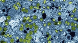 <p>iese kolorierte elektronenmikroskopische Aufnahme des National Institute of Allergy and Infectious Diseases aus dem Jahr 2024 zeigt Mpox-Viruspartikel (grün), die sich in infizierten kultivierten Zellen (blau) befinden. Die Viruspartikel befinden sich in verschiedenen Reifestadien, was zu Unterschieden in der Form führt.</p>