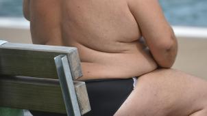 <p>Die Behandlung von Adipositas ist im Wandel.</p>