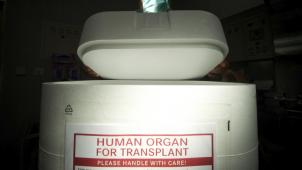 <p>Behälter zum Transport von Organen</p>