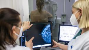 <p>Frauen im Alter von 50 bis 69 Jahren sollen alle zwei Jahre eine Einladung zu einem Mammografie-Screening erhalten.</p>