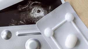 <p>Medikamente zum Schwangerschaftsabbruch vor einem Ultraschallbild: Viele Abtreibungen in Belgien erfolgen illegal oder im Ausland.</p>