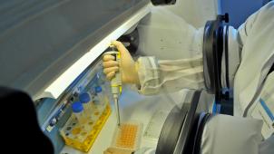 <p>Belgische Forscher entwickeln einen Biomarker, der das Risiko für eine seltene Form von Leukämie Jahre vor Ausbruch der Krankheit einschätzen kann.</p>