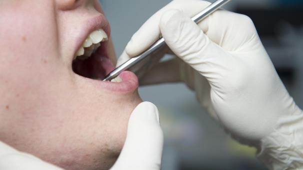<p>Aus Sicht der CKK sollten die Kosten für Zahnprothesen von der gesetzlichen Krankenversicherung übernommen werden.</p>
