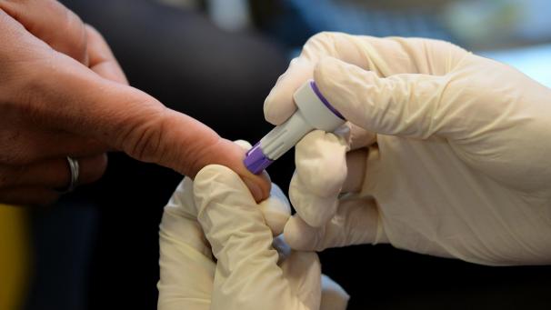 <p>Die Zahl der HIV-Infektionen ist in Belgien seit einigen Jahren rückläufig. Dennoch ist die Zahl der Infizierten immer noch hoch.</p>