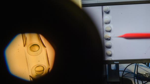 <p>Ein Mikroskop ist auf eine einzelne Zelle gerichtet in der während eines Crispr/Cas9 Verfahrens gerade eine Injektionsnadel steckt. Mit dem gentechnischen Verfahren wird am Universitätsklinikum Regensburg an einer Therapie gegen die angeborene Bluterkrankung Beta-Thalassämie gearbeitet.</p>