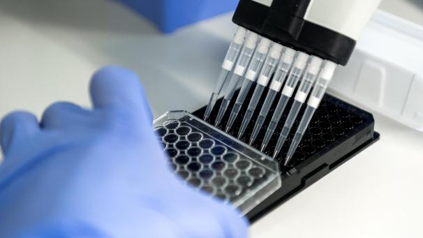 <p>Zusammen mit anderen Kliniken in Europa wird an der Uniklinik Gent nach neuen Krebsmedikamenten geforscht.</p>
