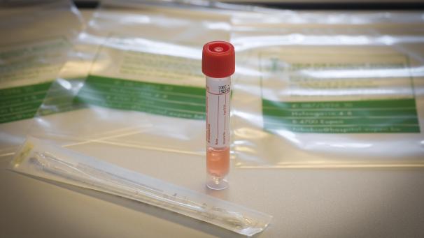 <p>Der Test auf das Coronavirus fiel positiv aus.</p>