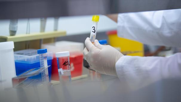<p>Eine Frau zeigt in einem Labor einen Test für das neue Coronavirus.</p>