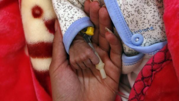 <p>Eine Frau hält das winzige Händchen ihres Babys, das auf der Station für unterernährte Kinder in einem Krankenhaus medizinisch versorgt wird.</p>