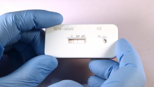<p>Ein Corona-Schnelltest: wie ein Schwangerschaftstest.</p>