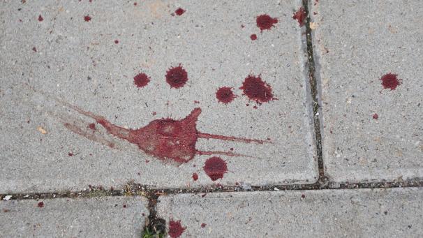 <p>Stolberg: Diese Blutspuren auf einem Gehweg stammen nach einer Zeugenaussage von zwei Männern, die von einem MEK der Polizei festgenommen wurden. Dabei soll es sich um einen Mann gehandelt haben, der eine möglicherweise islamistisch motivierte Attacke gegen einen Autofahrer ausgeführt hatte.</p>