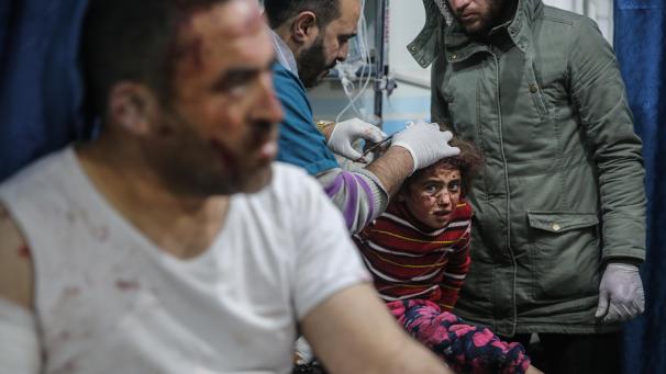 <p>Die sechsjährige Kenana Yassin, die zusammen mit drei Familienmitgliedern bei einem Luftangriff der syrischen Regierung auf die von den Rebellen kontrollierte Provinz Idlib verletzt wurde, wird behandelt.</p>