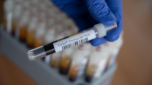 <p>Blutprobe für einen Corona-Antikörper-Test</p>