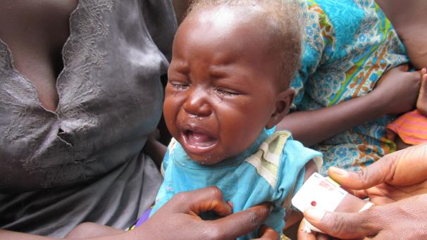 <p>Kongo, Kananga: Ein Baby wird gewogen und vermessen, um den Grad seiner Unterernährung zu ermitteln. Die rote Markierung am angelegten Armband signalisiert starke Unterernährung.</p>