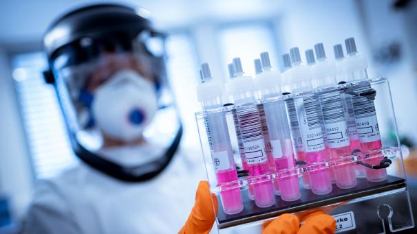 <p>Eine wissenschaftliche Mitarbeiterin hält Coronavirus-Testproben im Niedersächsischen Landesamt für Verbraucherschutz und Lebensmittelsicherheit (Laves) in der Hand.</p>